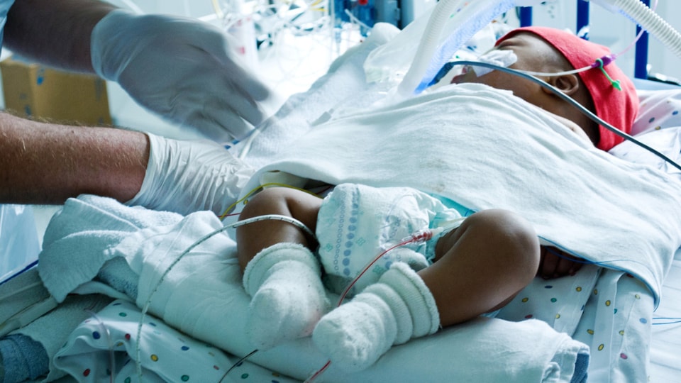 Newborn in hospital with monitors and breathing tube.