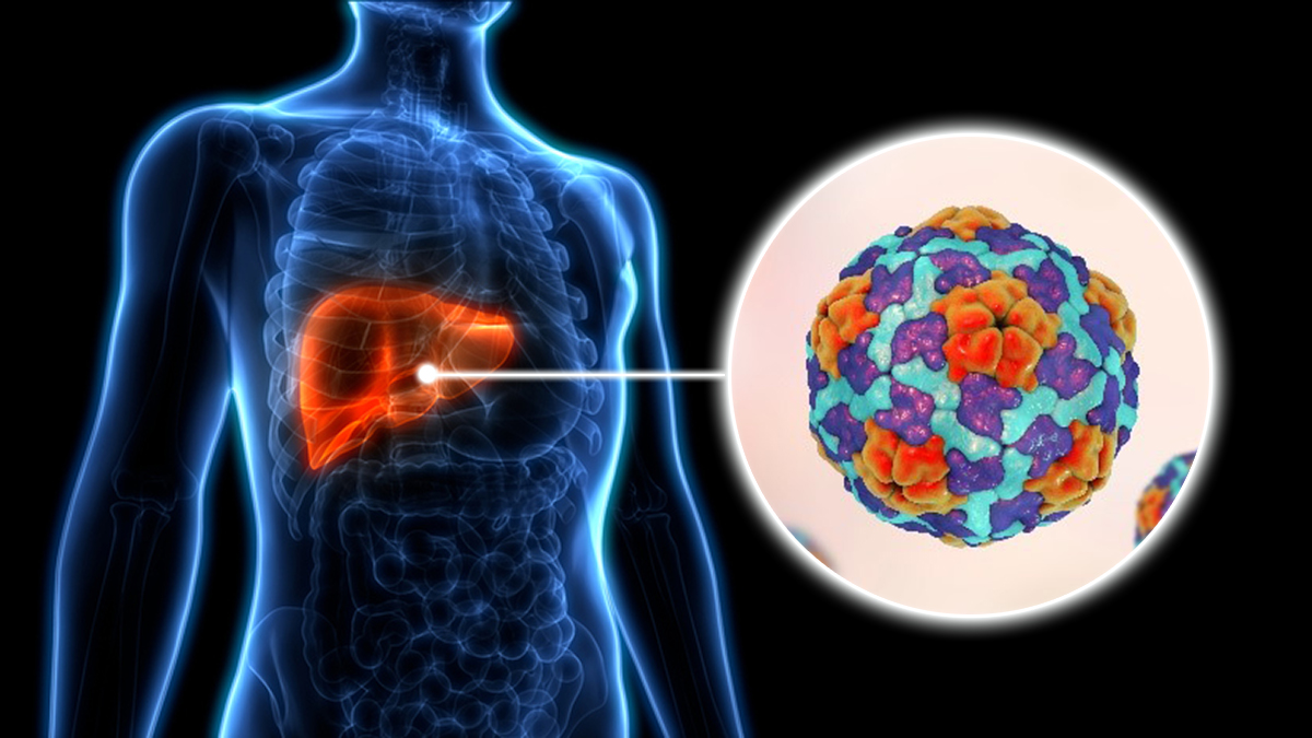 A representation of the hepatitis A virus in the liver