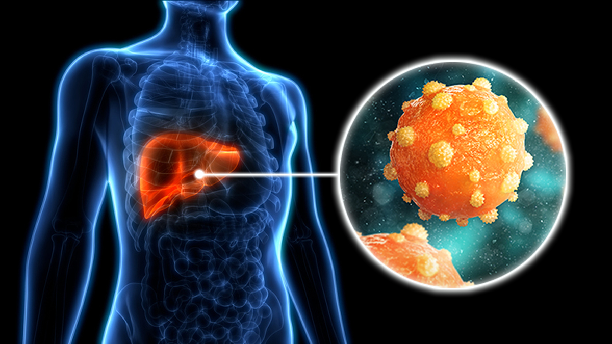 An illustration showing the hepatitis b virus in the liver