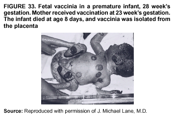 Figure 33